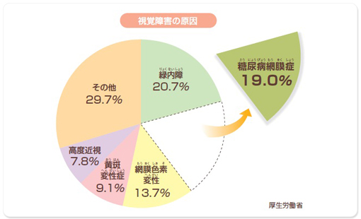 視覚障害の原因　糖尿病網膜剥離19.0％　緑内障20.7％　網膜色素変性13.7％　黄斑変性症9.1％　高度近視7.8％　その他29.7％　厚生労働省