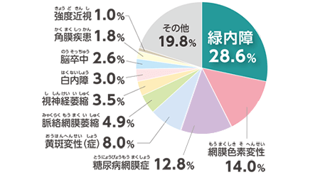 緑内障外来