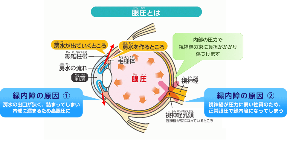 緑内障外来