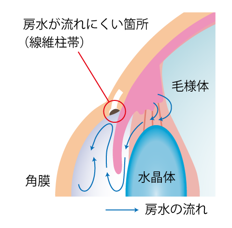 手術前