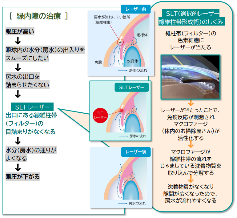 ■SLTの作用について