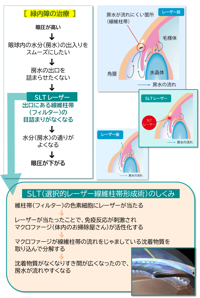 ■SLTの作用について